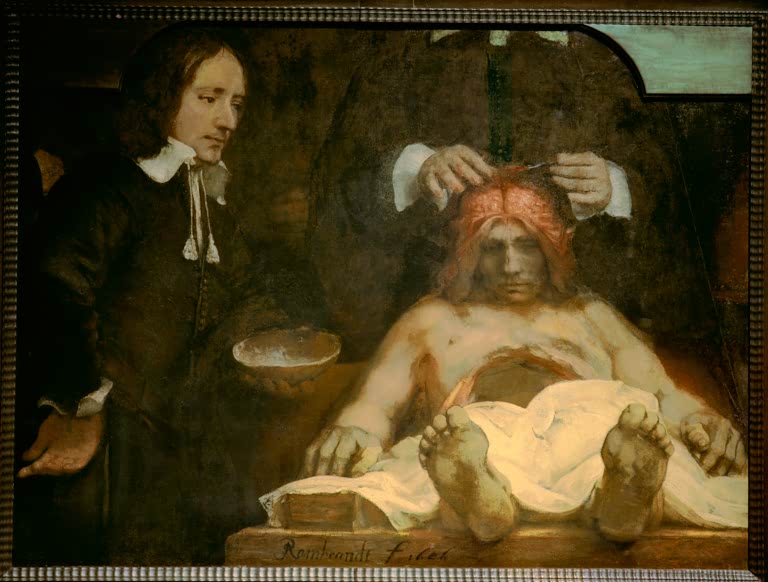 Die Anatomie des Dr. Johan Deijman | Rembrandt van Rijn