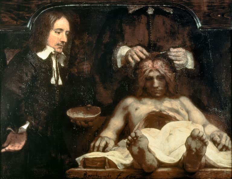 Die Anatomie des Dr. Johan Deijman | Rembrandt van Rijn